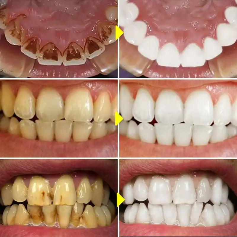 sixteen Teeth Whitening Powder