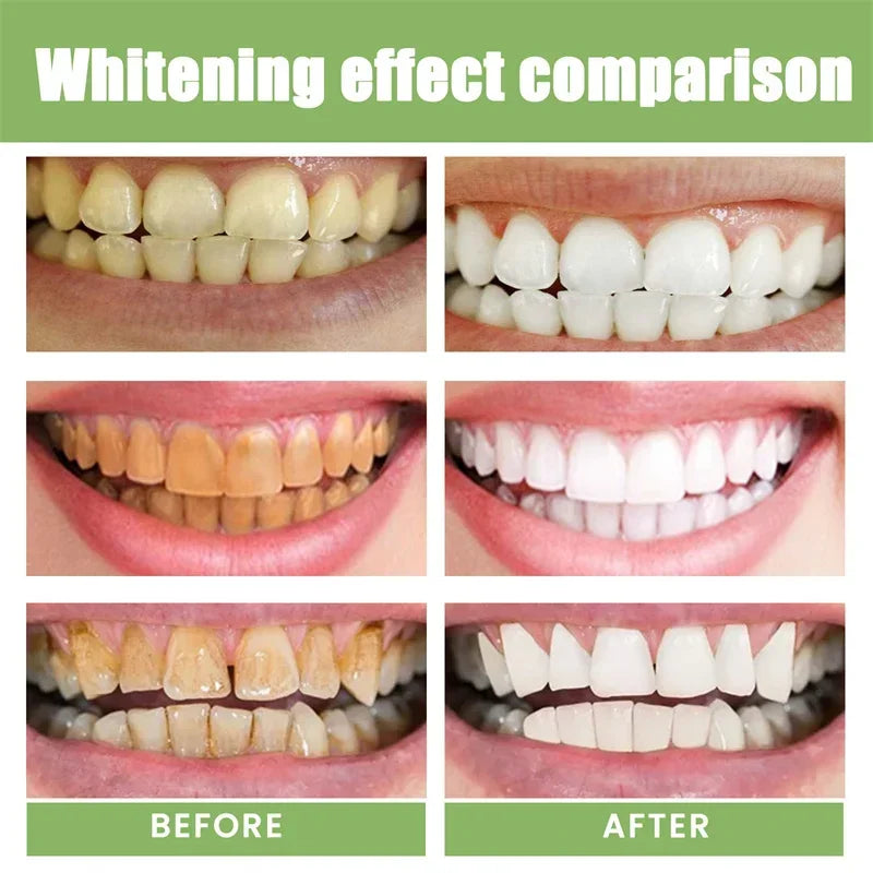 sixteen Teeth Whitening Powder