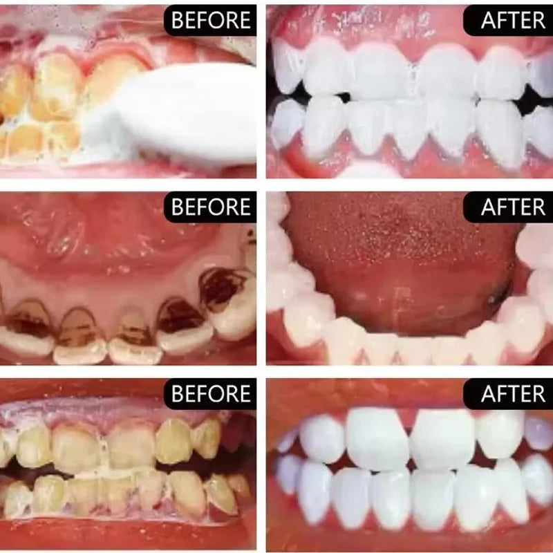 sixteen Teeth Whitening Powder