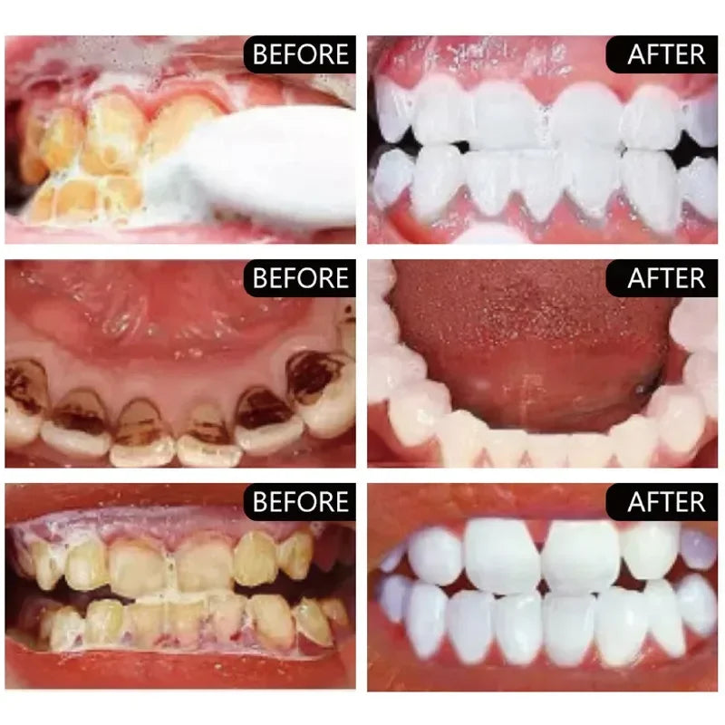 sixteen Teeth Whitening Powder
