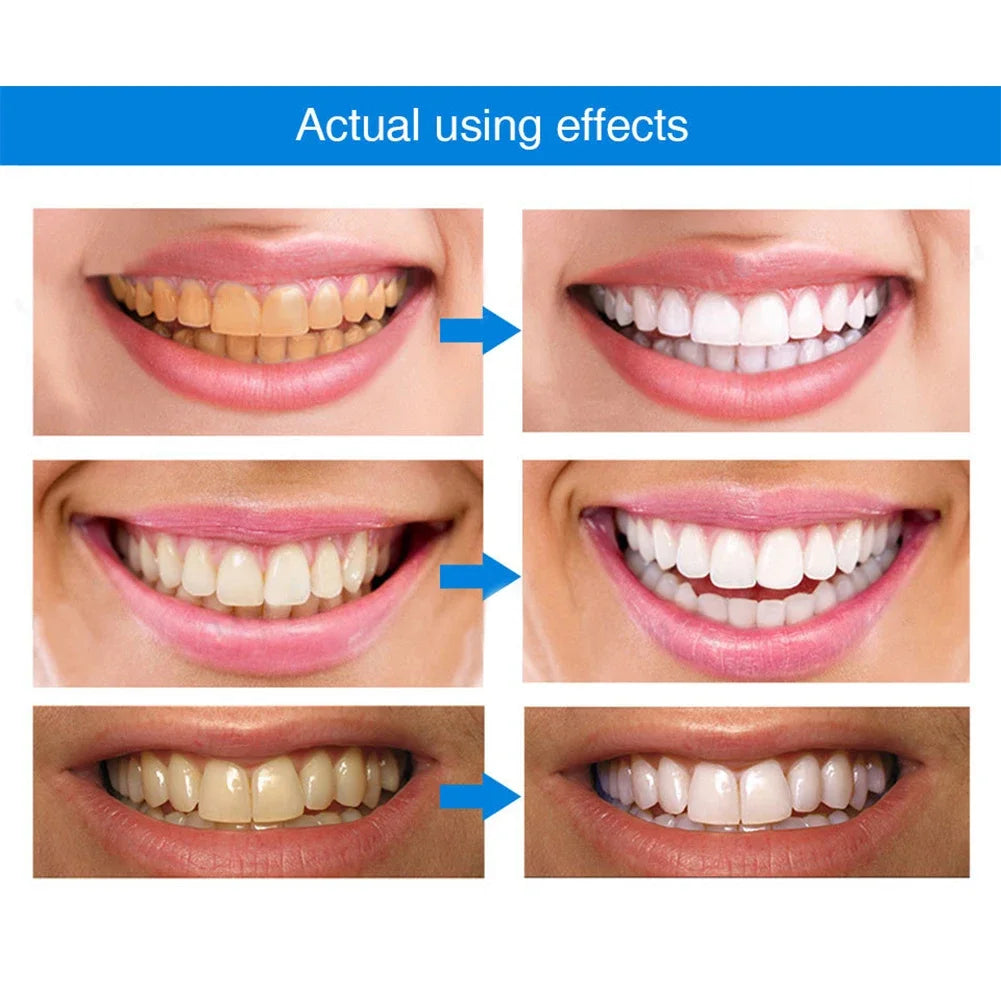 Sixteen Teeth Whitening Pen