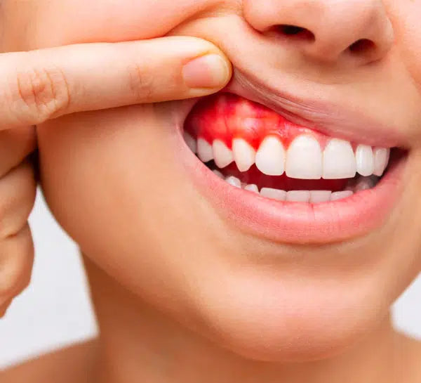 sixteen teeth anti-inflammatory stop your gum bleeding