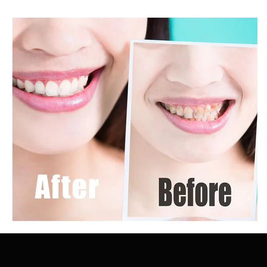 sixteen Teeth Whitening Strip Charcoal