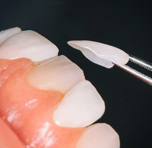 Dubai- One Tooth Enamel Veneer Voucher – No Teeth Shaving | 16Teeth