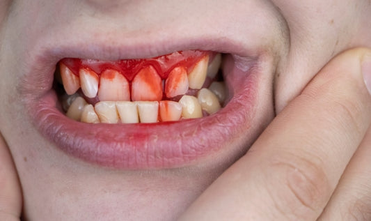 sixteen teeth anti-inflammatory stop your gum bleeding