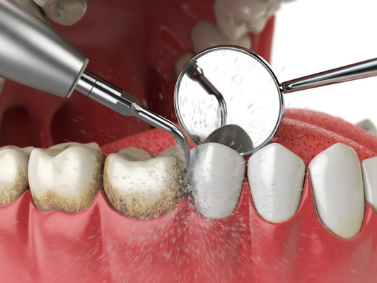 16Teeth Smile Coupon – Professional Teeth Cleaning & Polishing in Egypt